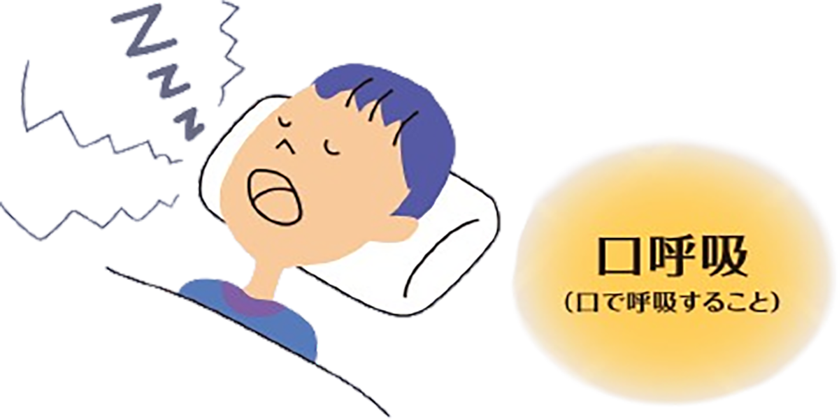 口呼吸（口で呼吸すること）